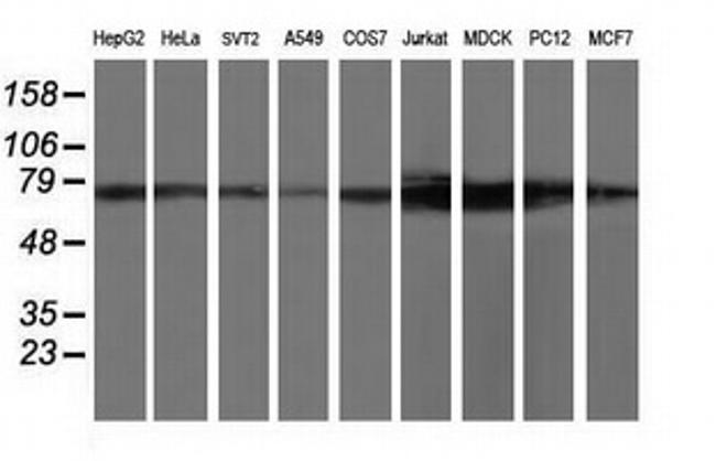 TTLL12 Antibody in Western Blot (WB)