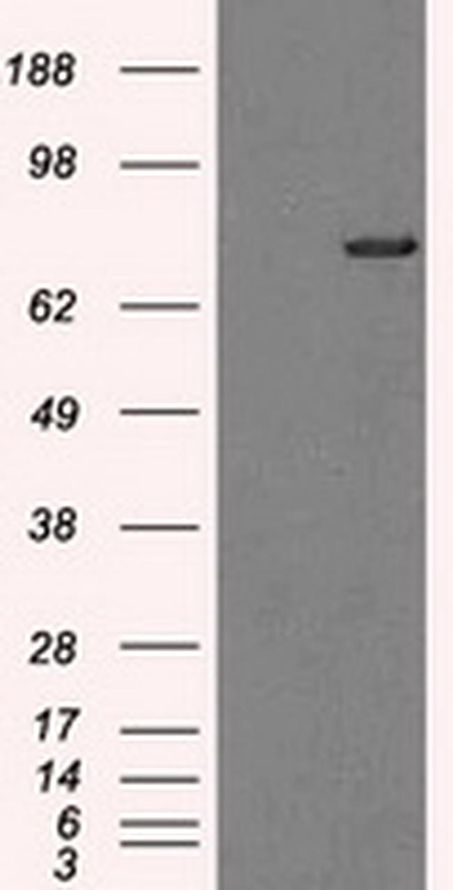 TTLL12 Antibody in Western Blot (WB)