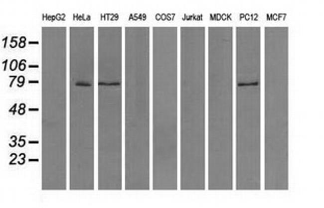 TTLL12 Antibody in Western Blot (WB)