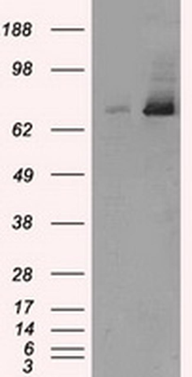 TTLL12 Antibody in Western Blot (WB)