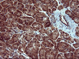 TUBA1B Antibody in Immunohistochemistry (Paraffin) (IHC (P))