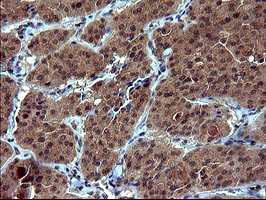 TUBA1B Antibody in Immunohistochemistry (Paraffin) (IHC (P))