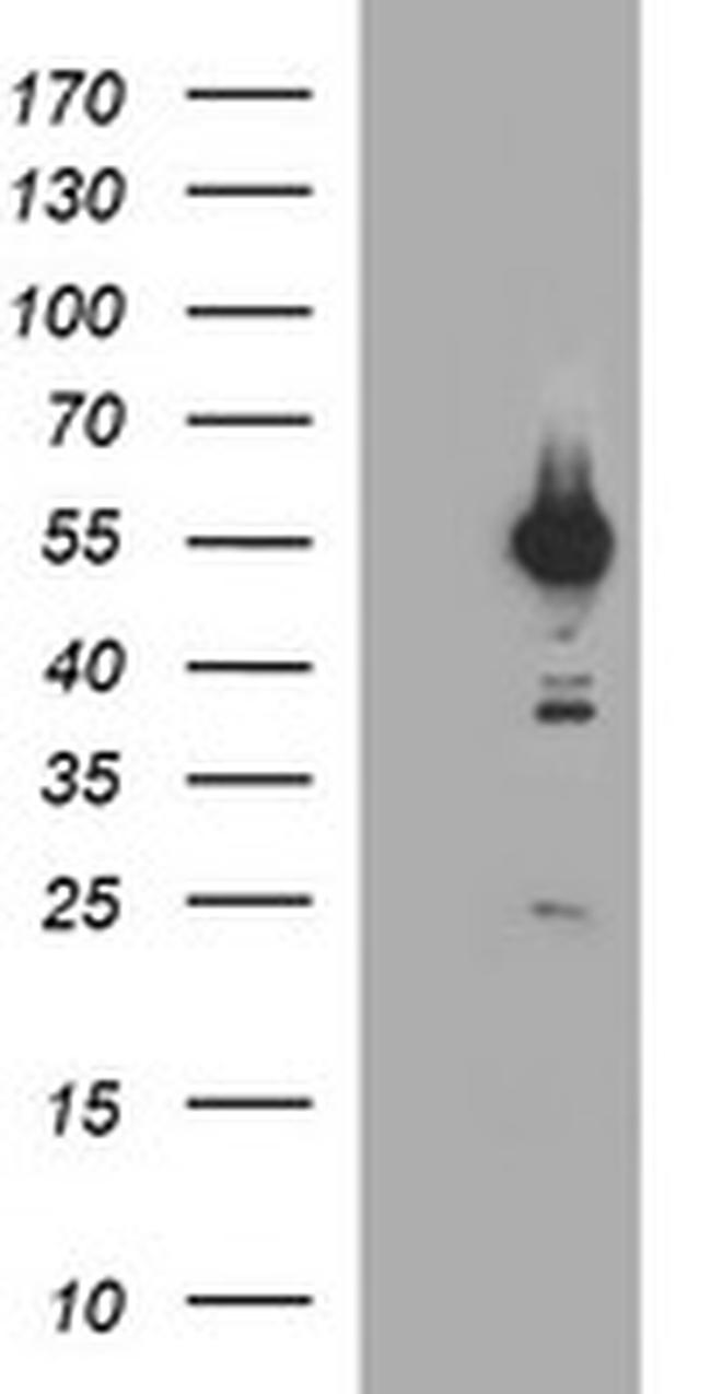 TUBA1B Antibody in Western Blot (WB)