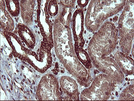 TUBB1 Antibody in Immunohistochemistry (Paraffin) (IHC (P))