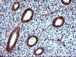 TUBB1 Antibody in Immunohistochemistry (Paraffin) (IHC (P))