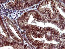 TUBB1 Antibody in Immunohistochemistry (Paraffin) (IHC (P))