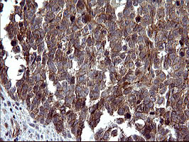 TUBB1 Antibody in Immunohistochemistry (Paraffin) (IHC (P))