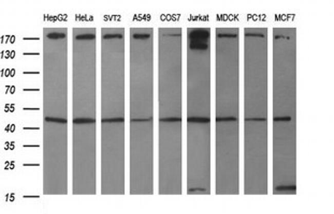 TUBB1 Antibody in Western Blot (WB)