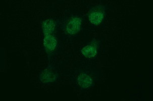 TUBB2B Antibody in Immunocytochemistry (ICC/IF)