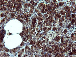 TUBB2B Antibody in Immunohistochemistry (Paraffin) (IHC (P))