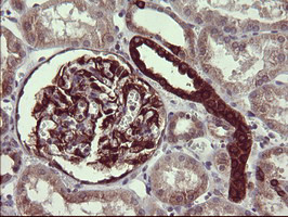 TUBB2B Antibody in Immunohistochemistry (Paraffin) (IHC (P))