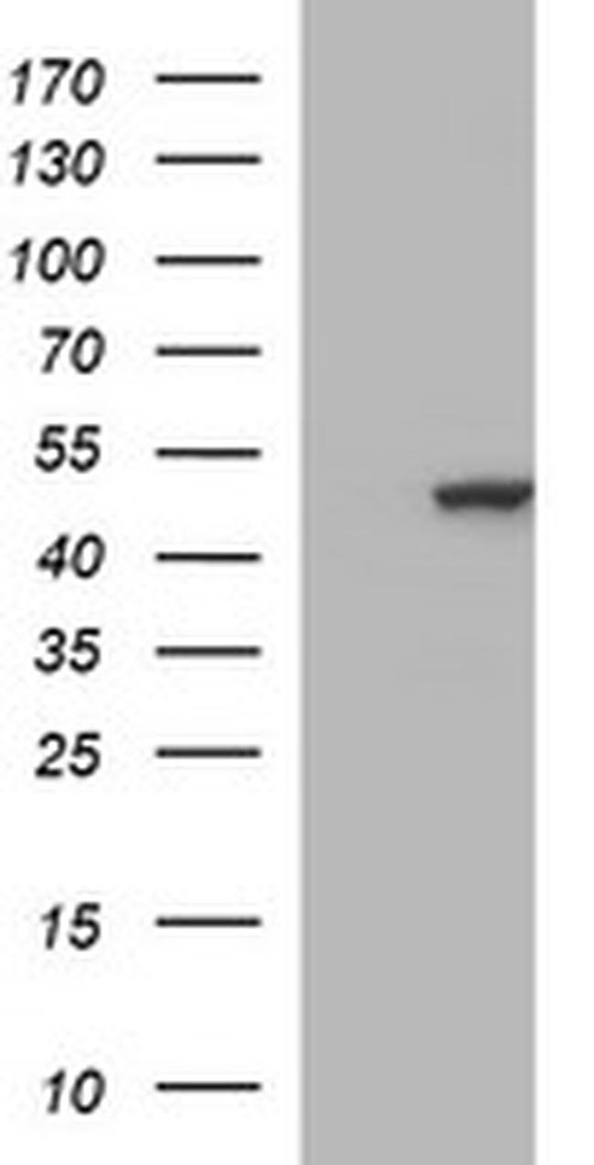 TUBB2B Antibody in Western Blot (WB)