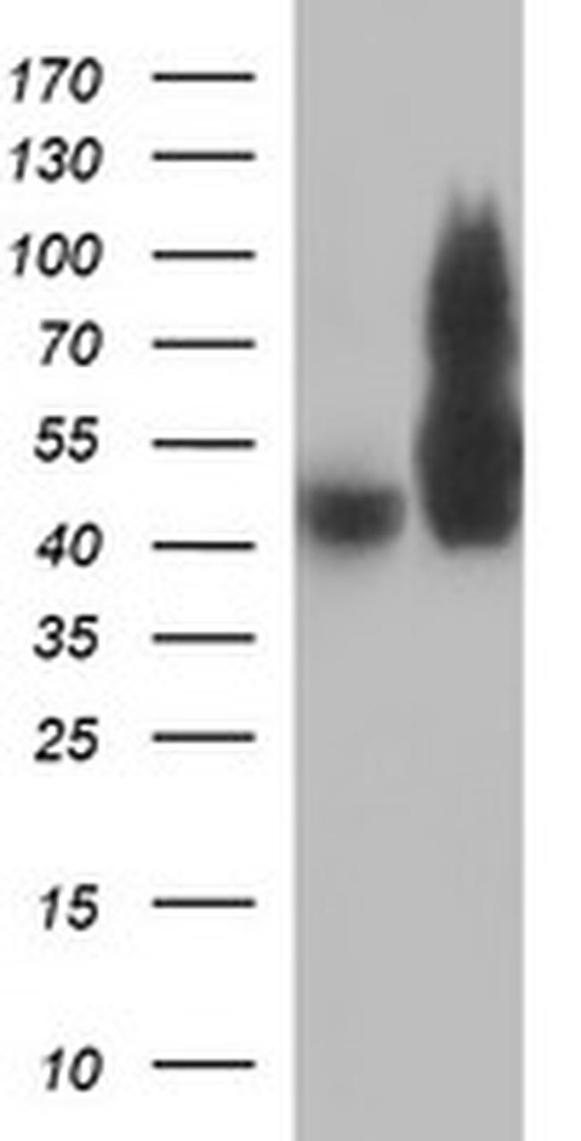 TUBB2B Antibody in Western Blot (WB)