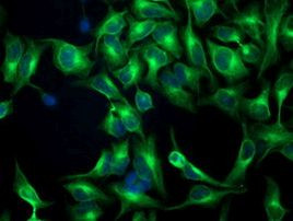 TUBB4 Antibody in Immunocytochemistry (ICC/IF)