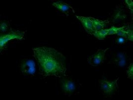 TUBB4 Antibody in Immunocytochemistry (ICC/IF)