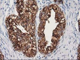 TUBB4 Antibody in Immunohistochemistry (Paraffin) (IHC (P))