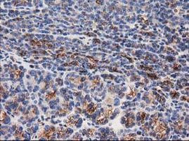 TUBB4 Antibody in Immunohistochemistry (Paraffin) (IHC (P))