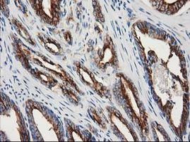 TUBB4 Antibody in Immunohistochemistry (Paraffin) (IHC (P))