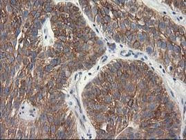 TUBB4 Antibody in Immunohistochemistry (Paraffin) (IHC (P))