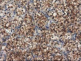 TUBB4 Antibody in Immunohistochemistry (Paraffin) (IHC (P))