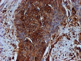 TUBB4 Antibody in Immunohistochemistry (Paraffin) (IHC (P))