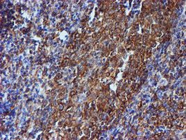 TUBB4 Antibody in Immunohistochemistry (Paraffin) (IHC (P))