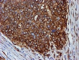 TUBB4 Antibody in Immunohistochemistry (Paraffin) (IHC (P))