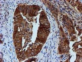 TUBB4 Antibody in Immunohistochemistry (Paraffin) (IHC (P))