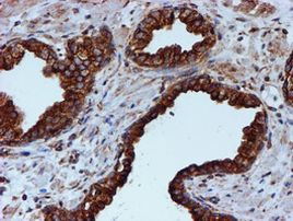 TUBB4 Antibody in Immunohistochemistry (Paraffin) (IHC (P))