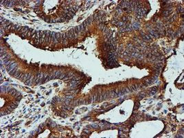 TUBB4 Antibody in Immunohistochemistry (Paraffin) (IHC (P))