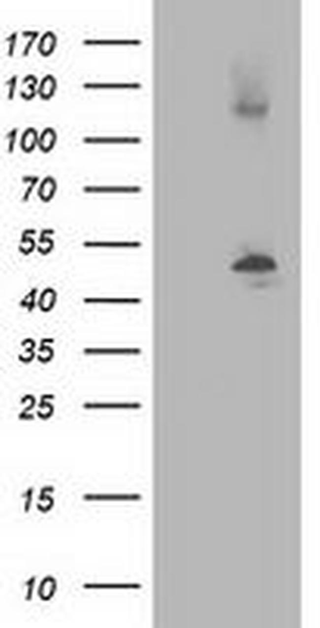 TUBB4 Antibody in Western Blot (WB)