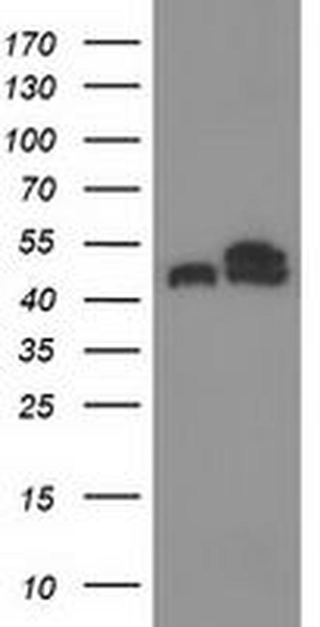 TUBB4 Antibody in Western Blot (WB)