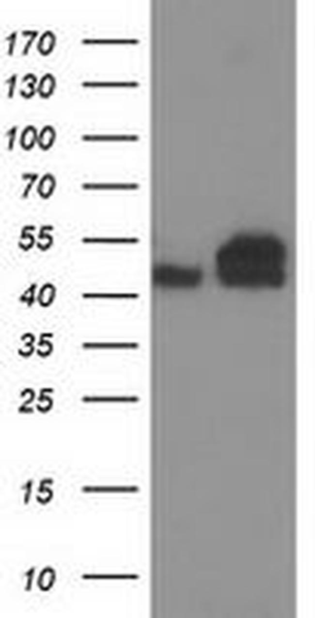 TUBB4 Antibody in Western Blot (WB)