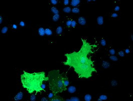 TULP3 Antibody in Immunocytochemistry (ICC/IF)