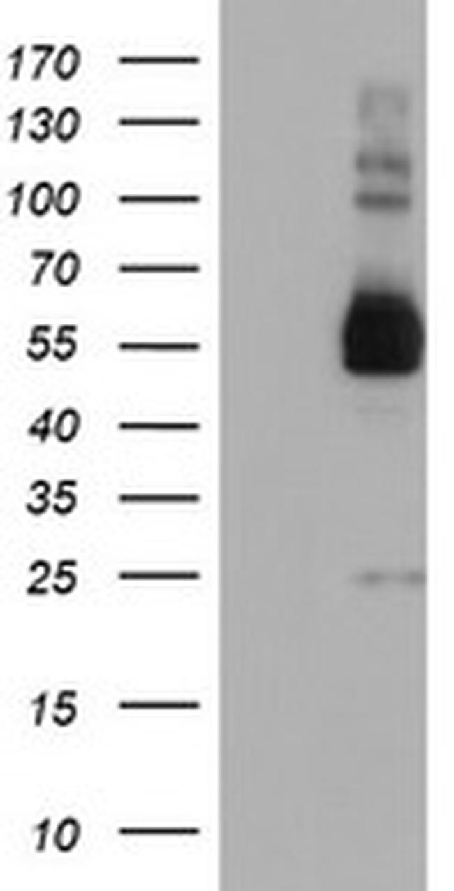 TULP3 Antibody in Western Blot (WB)