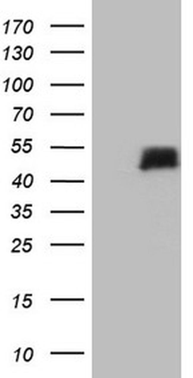 TWF1 Antibody in Western Blot (WB)