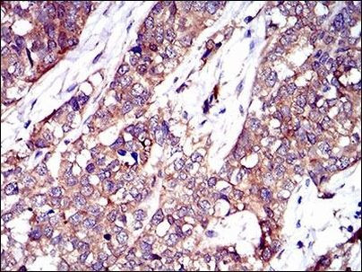 PTK9 Antibody in Immunohistochemistry (Paraffin) (IHC (P))