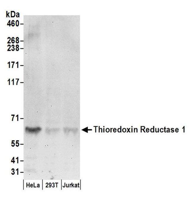 Thioredoxin Reductase 1/TXNRD1/TRXR1 Antibody in Western Blot (WB)