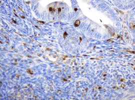 TYMP Antibody in Immunohistochemistry (Paraffin) (IHC (P))