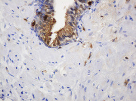 TYMP Antibody in Immunohistochemistry (Paraffin) (IHC (P))