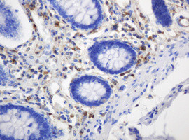 TYMP Antibody in Immunohistochemistry (Paraffin) (IHC (P))