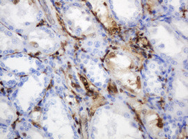 TYMP Antibody in Immunohistochemistry (Paraffin) (IHC (P))