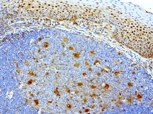 TYMP Antibody in Immunohistochemistry (Paraffin) (IHC (P))