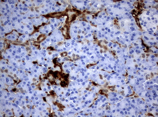 TYMP Antibody in Immunohistochemistry (Paraffin) (IHC (P))