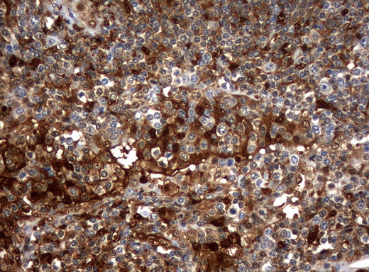 TYMP Antibody in Immunohistochemistry (Paraffin) (IHC (P))