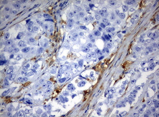 TYMP Antibody in Immunohistochemistry (Paraffin) (IHC (P))