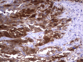 TYMS Antibody in Immunohistochemistry (Paraffin) (IHC (P))