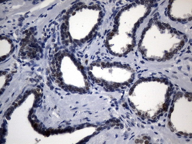 TYMS Antibody in Immunohistochemistry (Paraffin) (IHC (P))