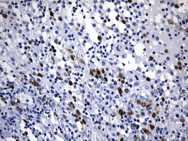 TYMS Antibody in Immunohistochemistry (Paraffin) (IHC (P))