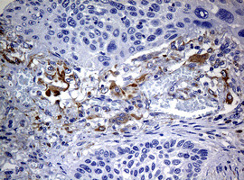 TYR Antibody in Immunohistochemistry (Paraffin) (IHC (P))